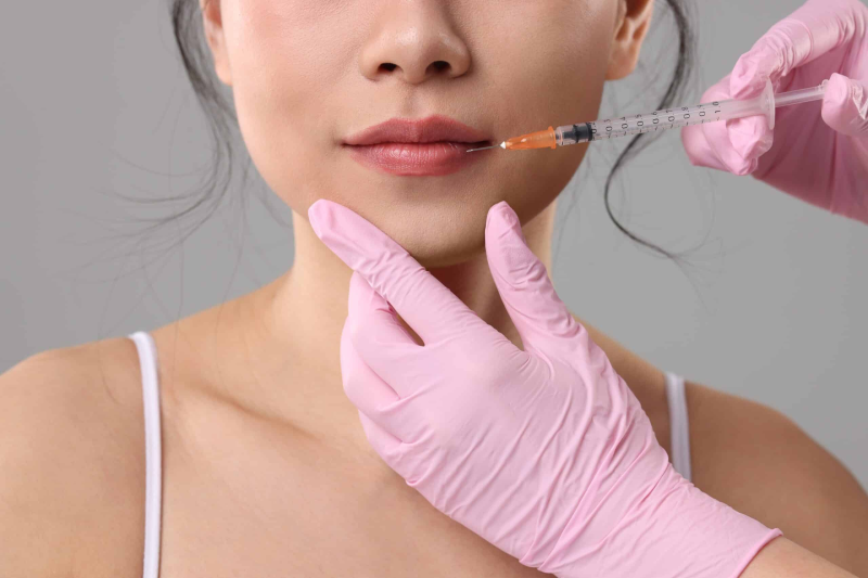 Aesthetics Lip Filler in Savannah GA
