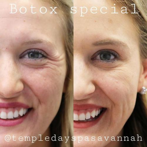 Aesthetically Savy med spa Botox treatment room in Savannah, GA