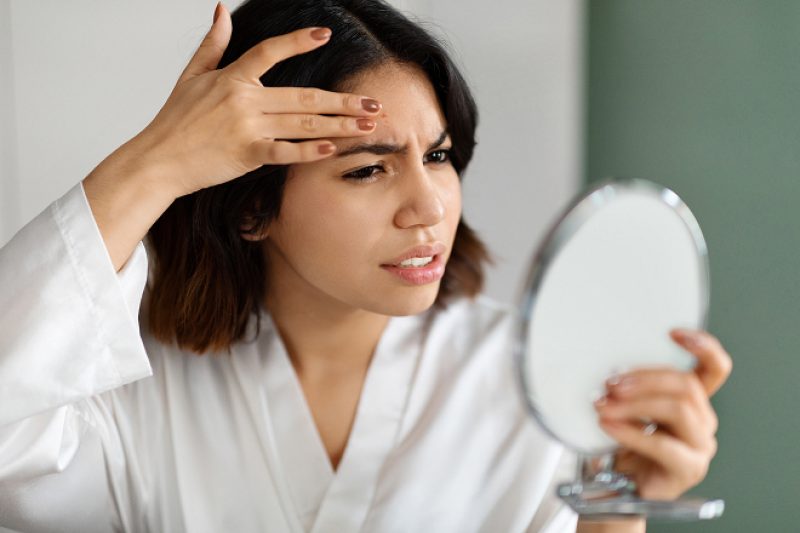 Dull, Tired Skin Common Causes and Effective Treatment Options